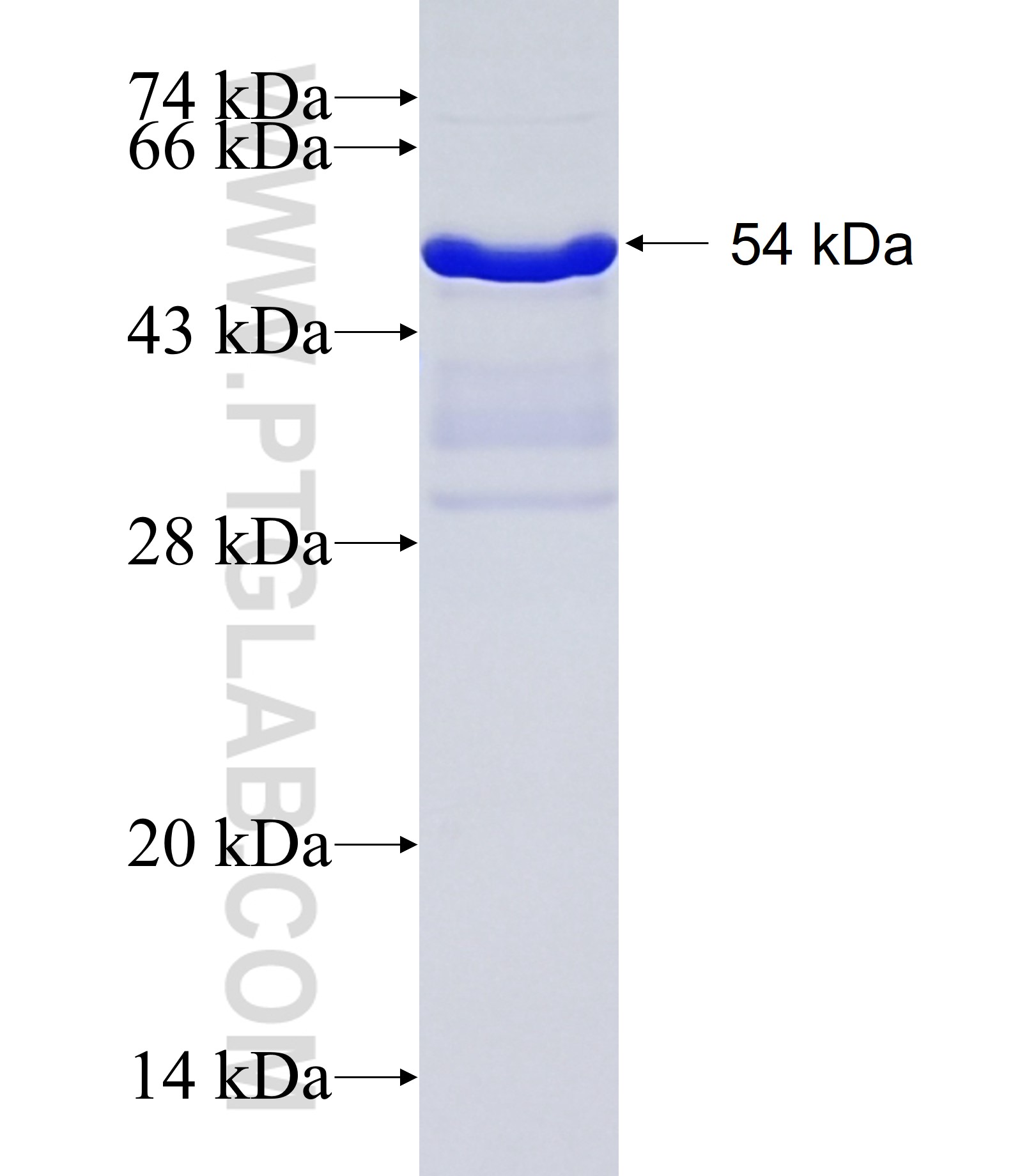 RGS19 fusion protein Ag2358 SDS-PAGE RGS19 fusion protein Ag2358 SDS-PAGE