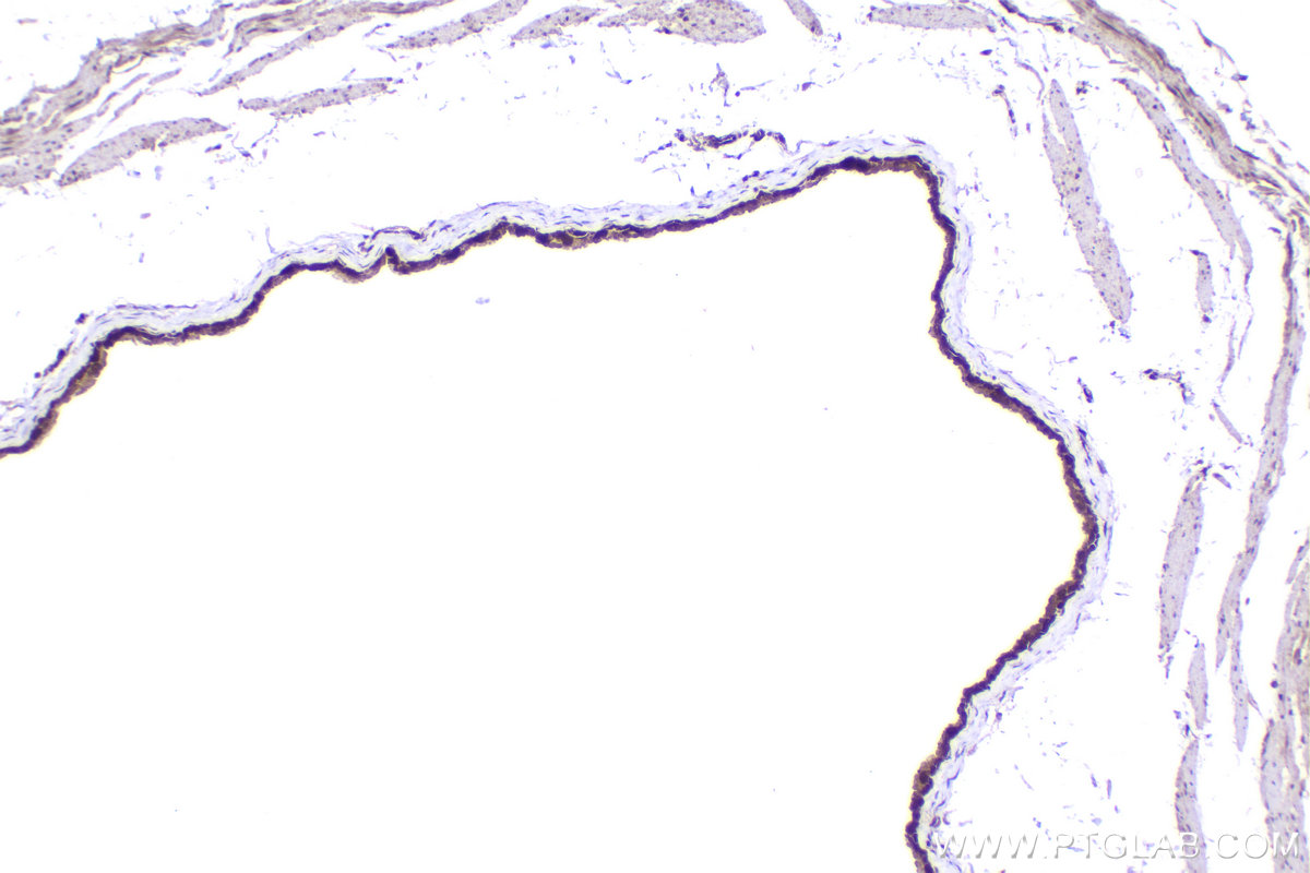 IHC staining of mouse bladder using 10678-1-AP IHC staining of mouse bladder using 10678-1-AP