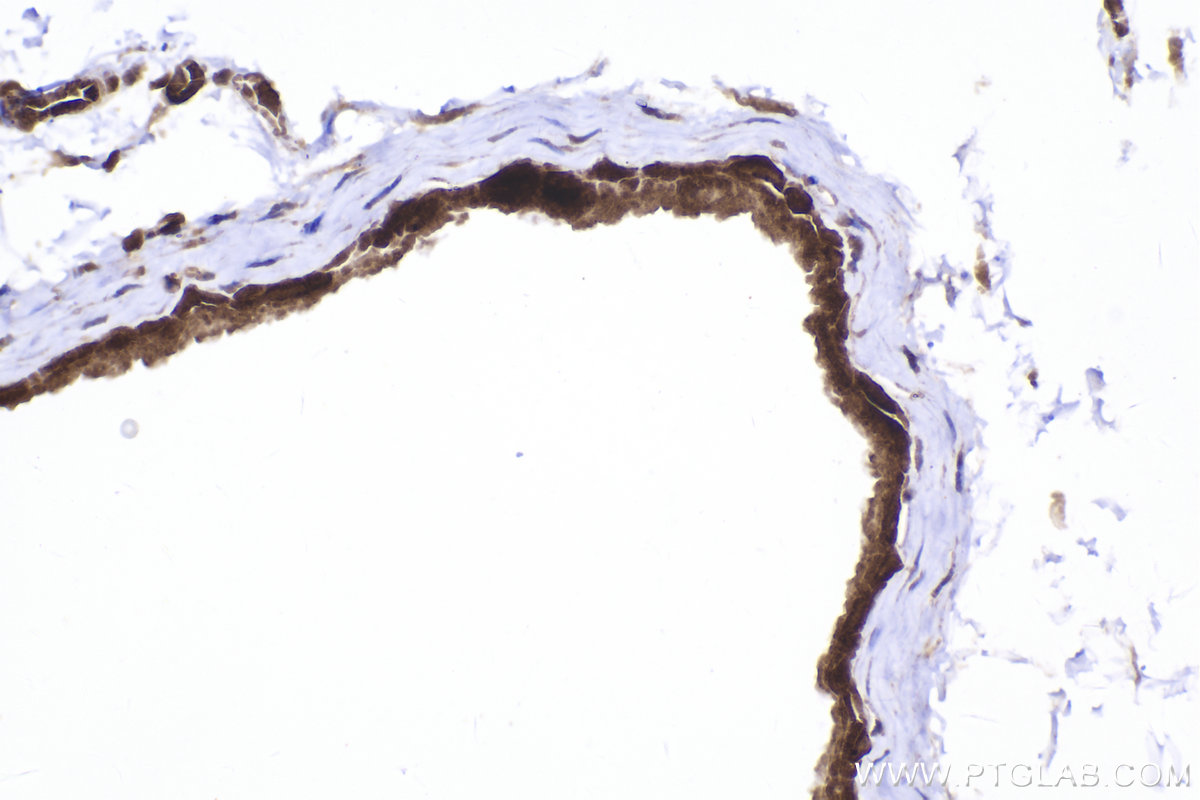 IHC staining of mouse bladder using 10678-1-AP IHC staining of mouse bladder using 10678-1-AP