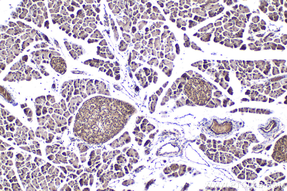 IHC staining of mouse pancreas using 10678-1-AP IHC staining of mouse pancreas using 10678-1-AP