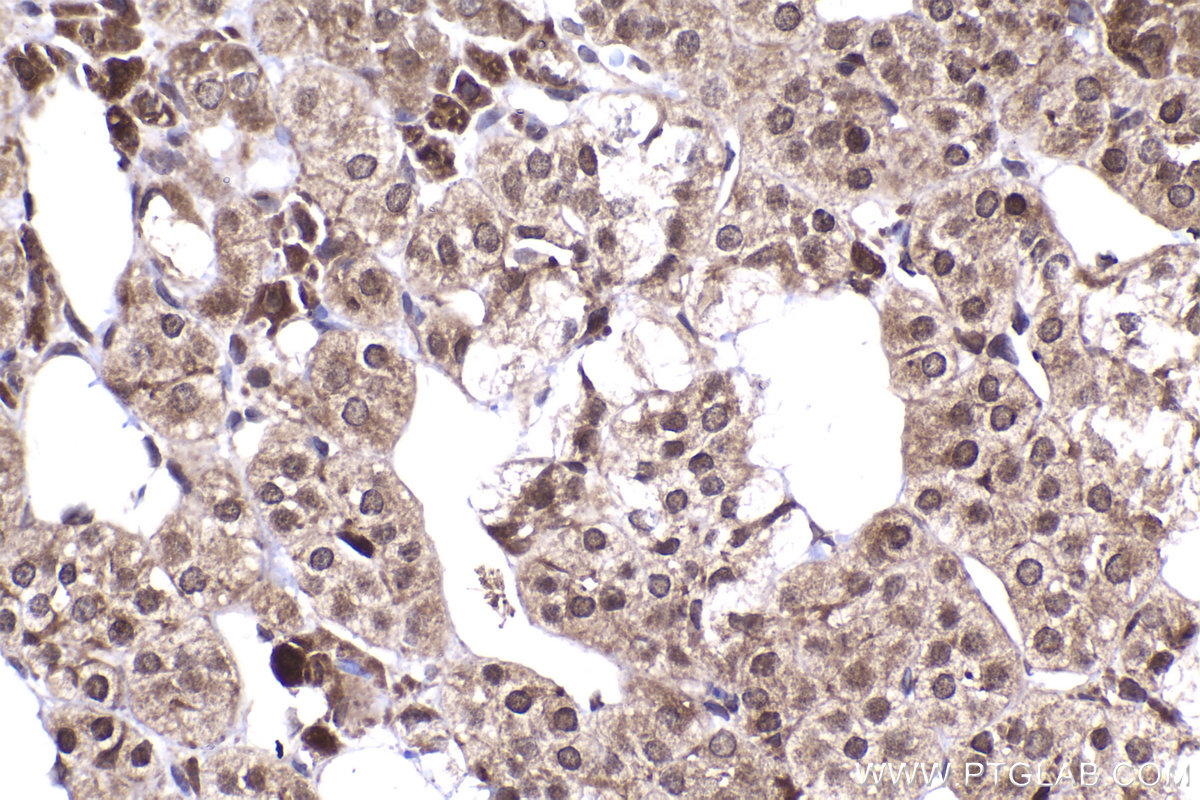 IHC staining of rat adrenal gland using 10678-1-AP IHC staining of rat adrenal gland using 10678-1-AP