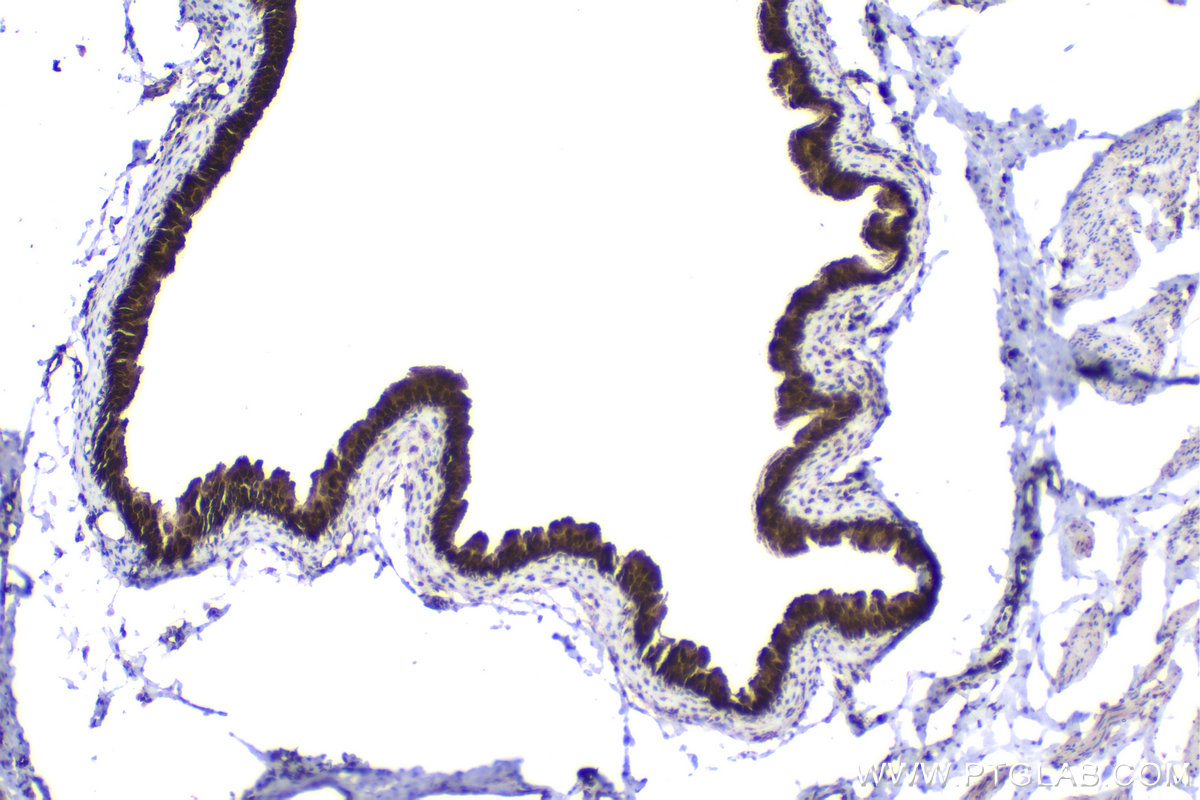IHC staining of rat bladder using 10678-1-AP IHC staining of rat bladder using 10678-1-AP