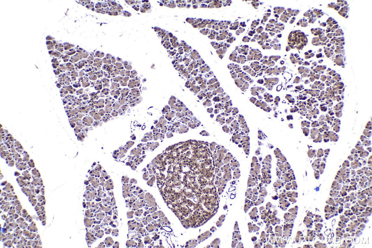 IHC staining of rat pancreas using 10678-1-AP IHC staining of rat pancreas using 10678-1-AP