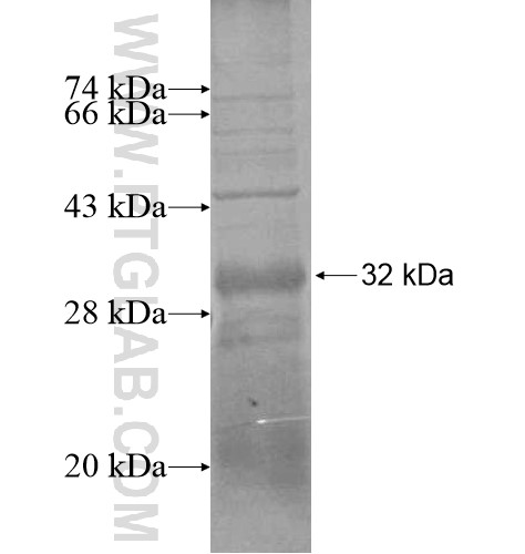 RGS20 fusion protein Ag14442 SDS-PAGE RGS20 fusion protein Ag14442 SDS-PAGE
