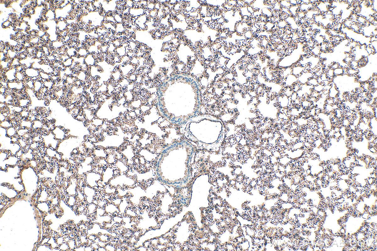 IHC staining of mouse lung using 14530-1-AP