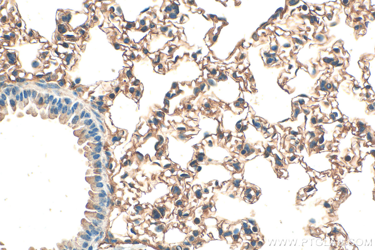 IHC staining of mouse lung using 14530-1-AP