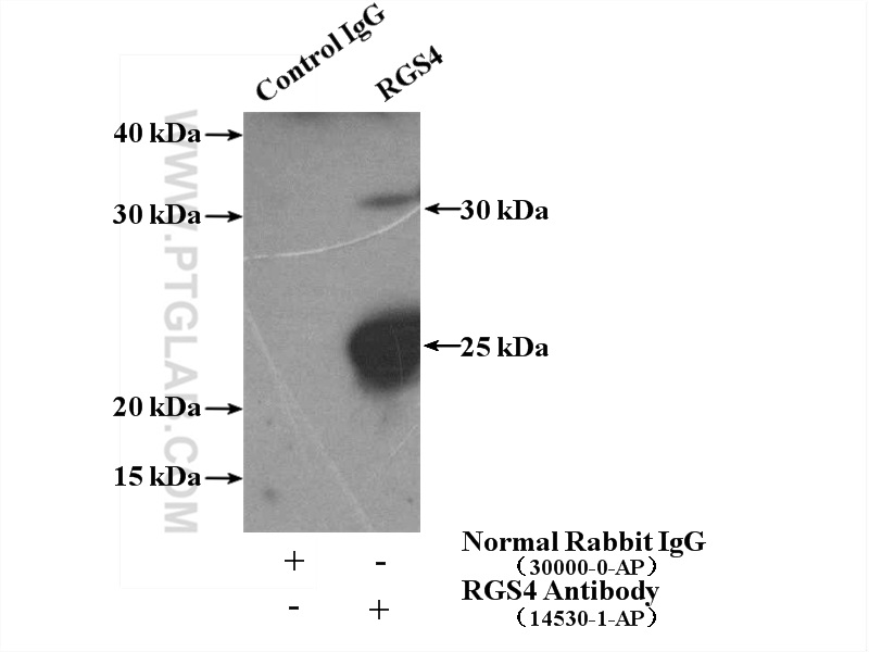 IP experiment of mouse brain using 14530-1-AP