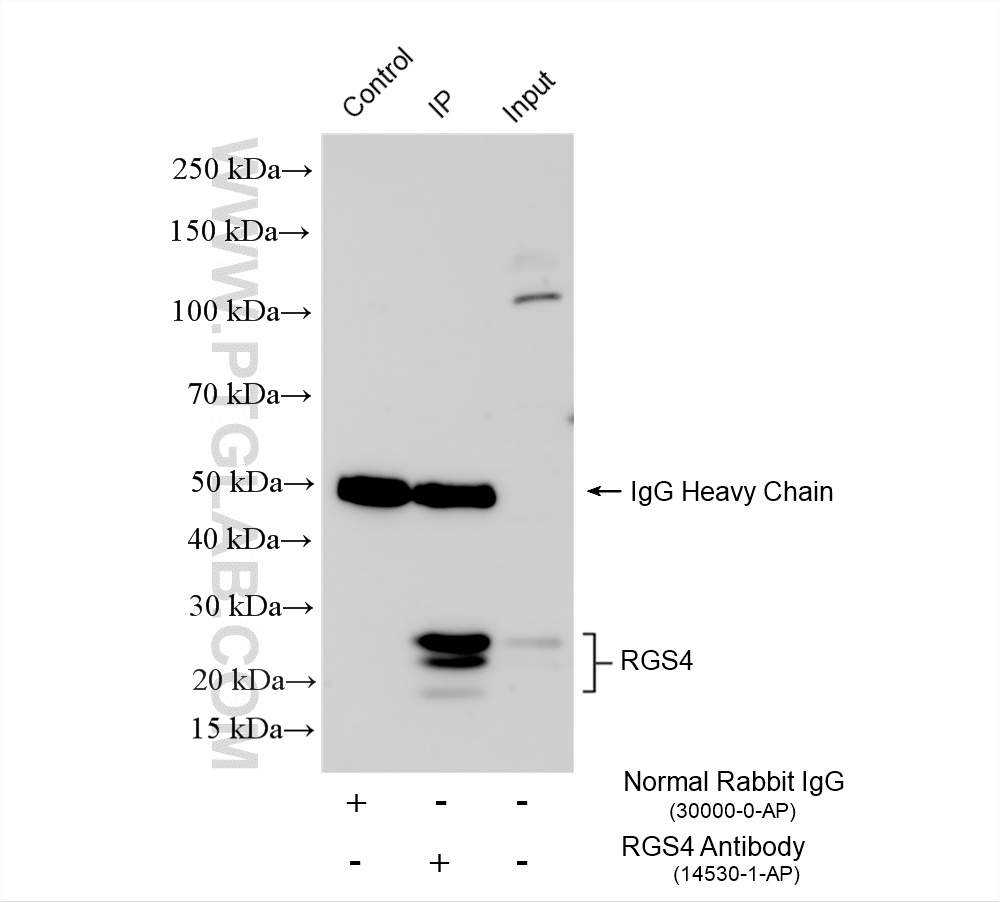 IP experiment of SH-SY5Y using 14530-1-AP