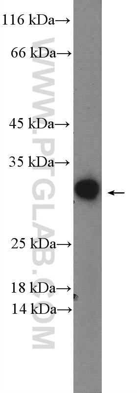 WB analysis of mouse cerebellum using 14530-1-AP