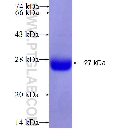 RGS4 fusion protein Ag6583 SDS-PAGE RGS4 fusion protein Ag6583 SDS-PAGE