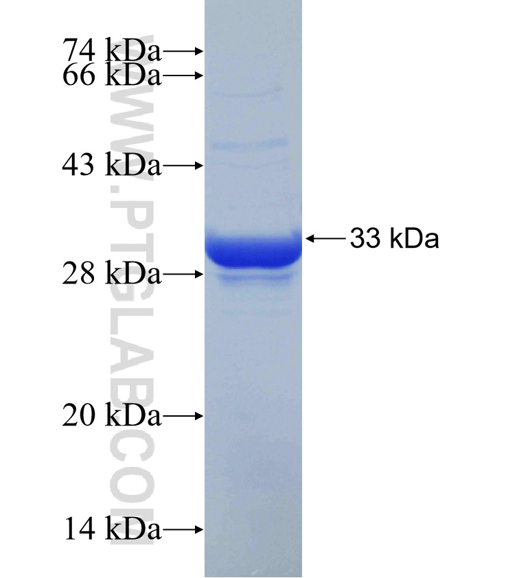RGS5 fusion protein Ag30455 SDS-PAGE