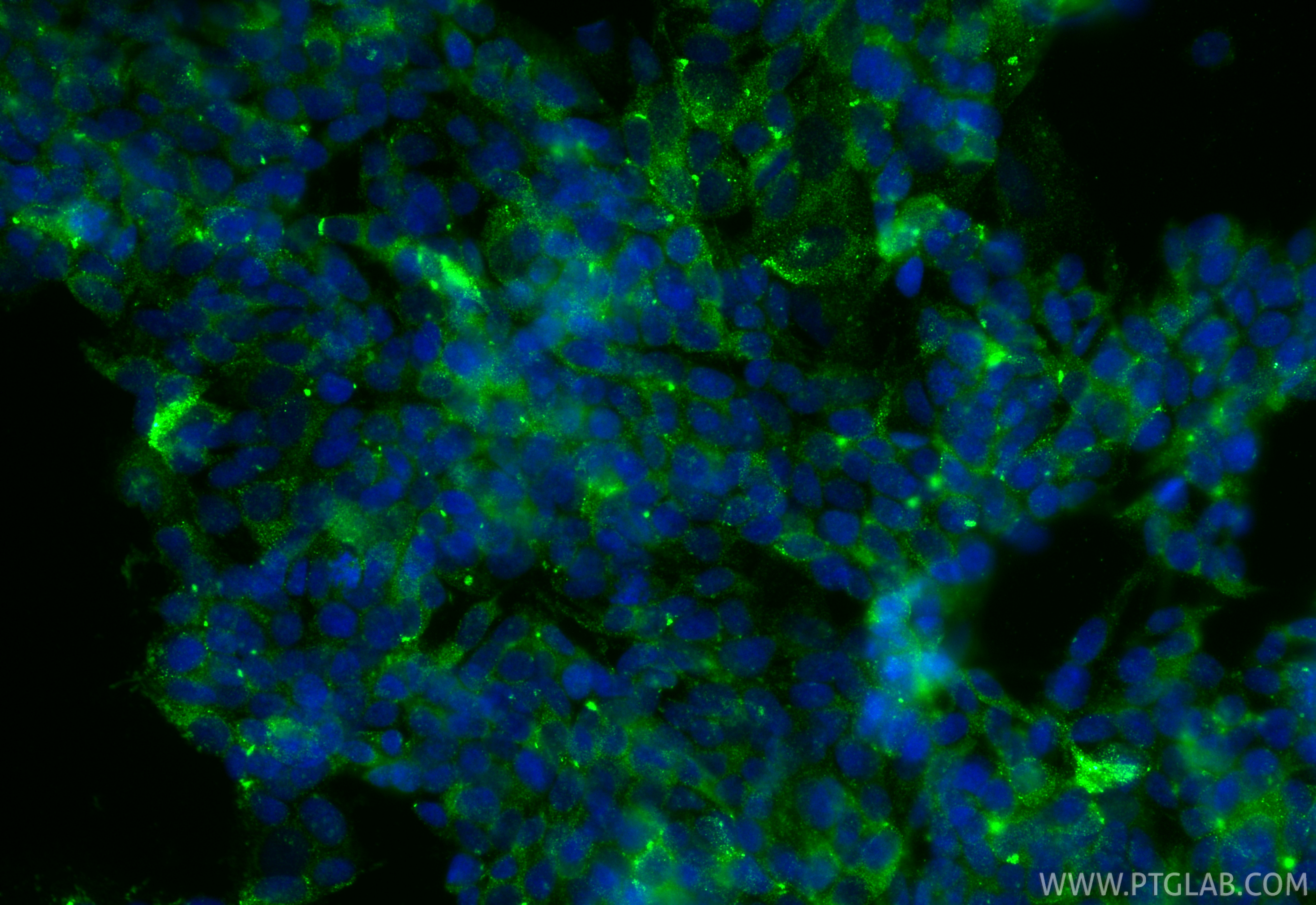 IF Staining of SH-SY5Y using 14056-1-AP IF Staining of SH-SY5Y using 14056-1-AP