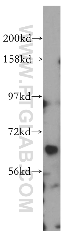 WB analysis of SH-SY5Y using 14056-1-AP