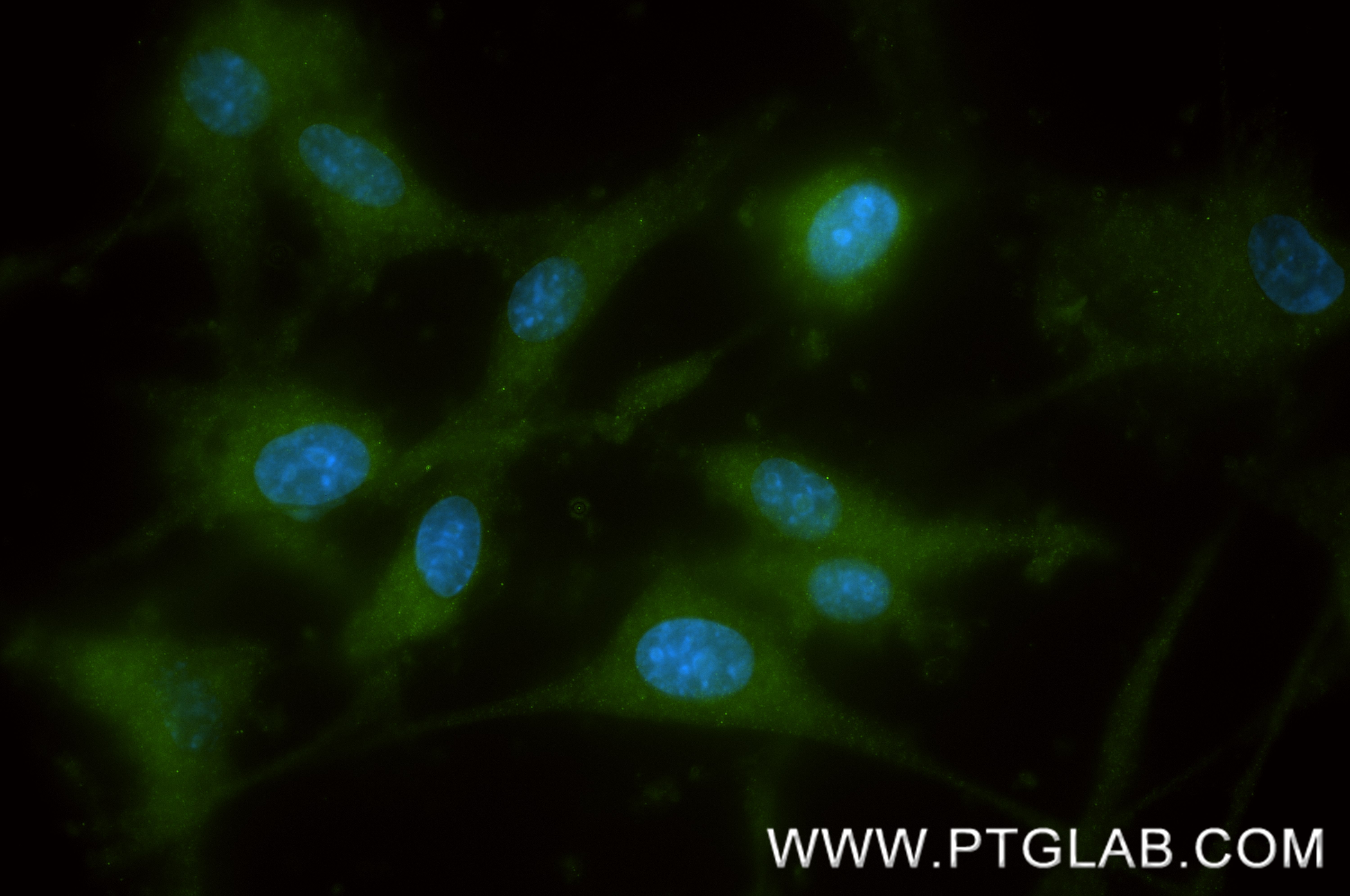 IF Staining of U-87 MG using 86846-2-RR (same clone as 86846-2-PBS) IF Staining of U-87 MG using 86846-2-RR (same clone as 86846-2-PBS)