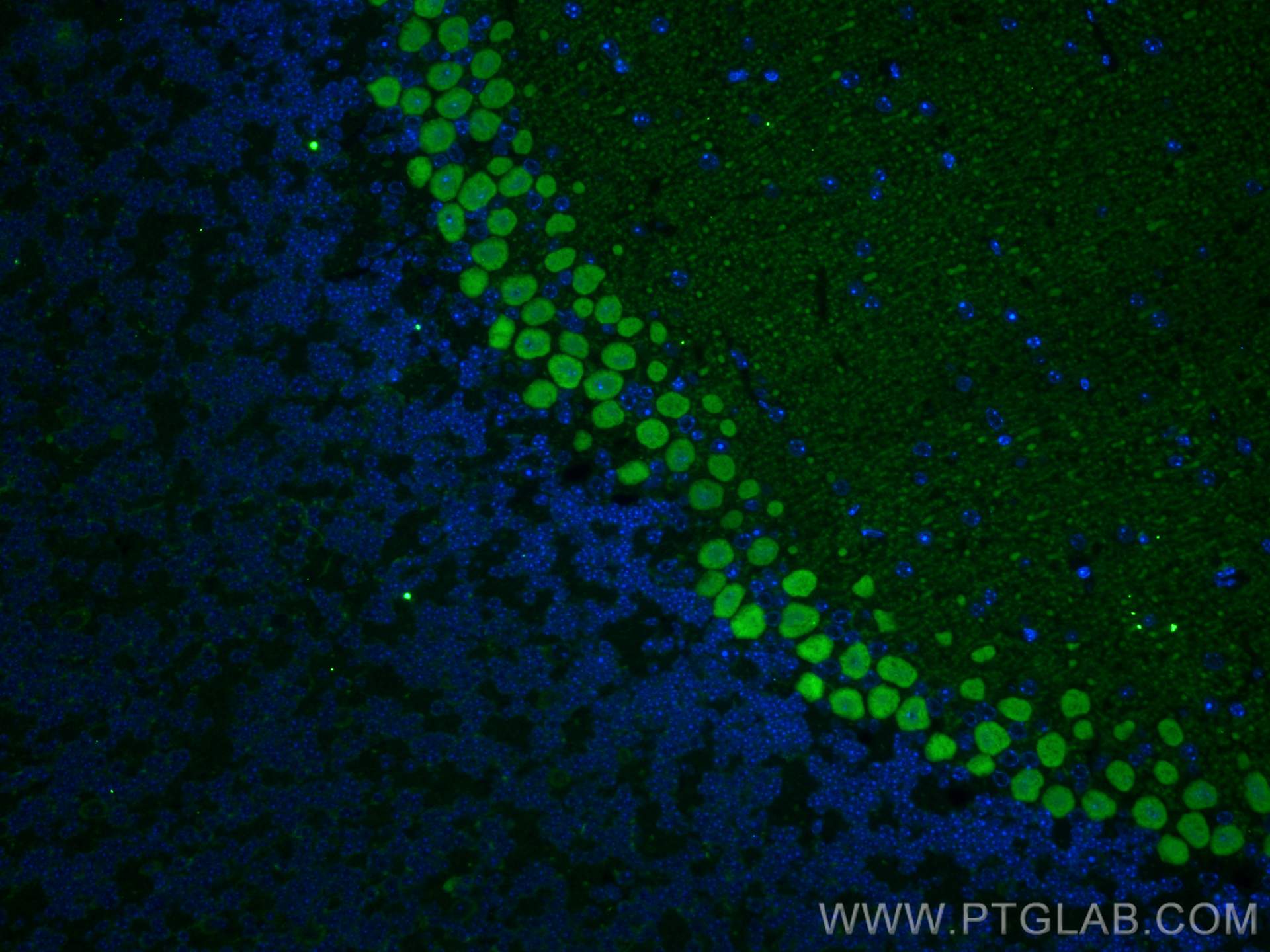 IF Staining of mouse cerebellum using 27394-1-AP