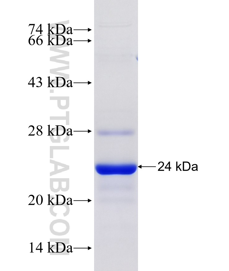 RGS8 fusion protein Ag26561 SDS-PAGE