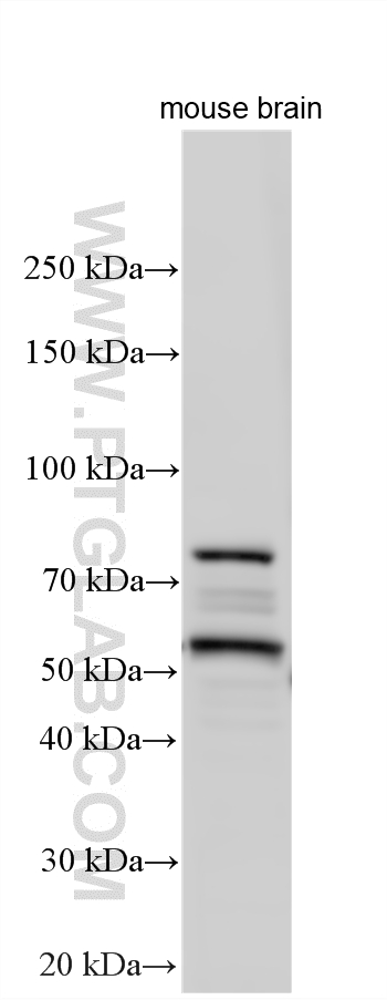 WB analysis of mouse brain using 17970-1-AP