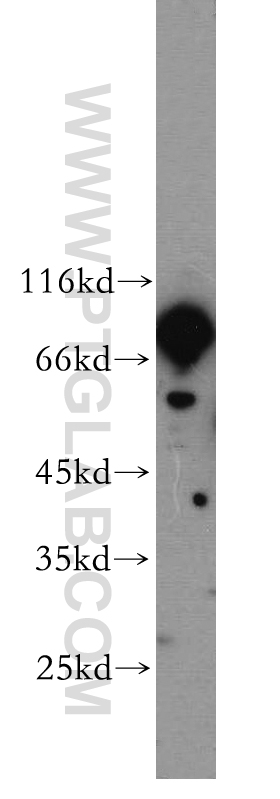 WB analysis of mouse brain using 17970-1-AP