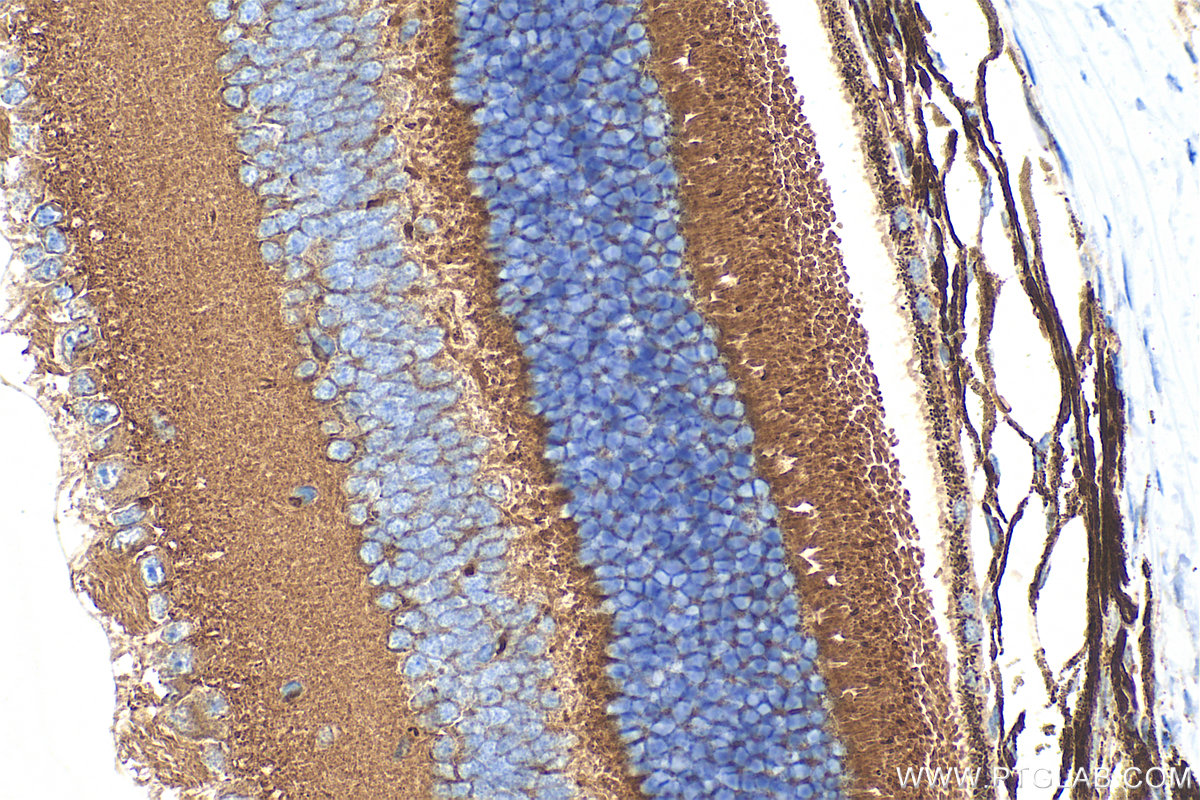 IHC staining of mouse eye using 33040-1-AP