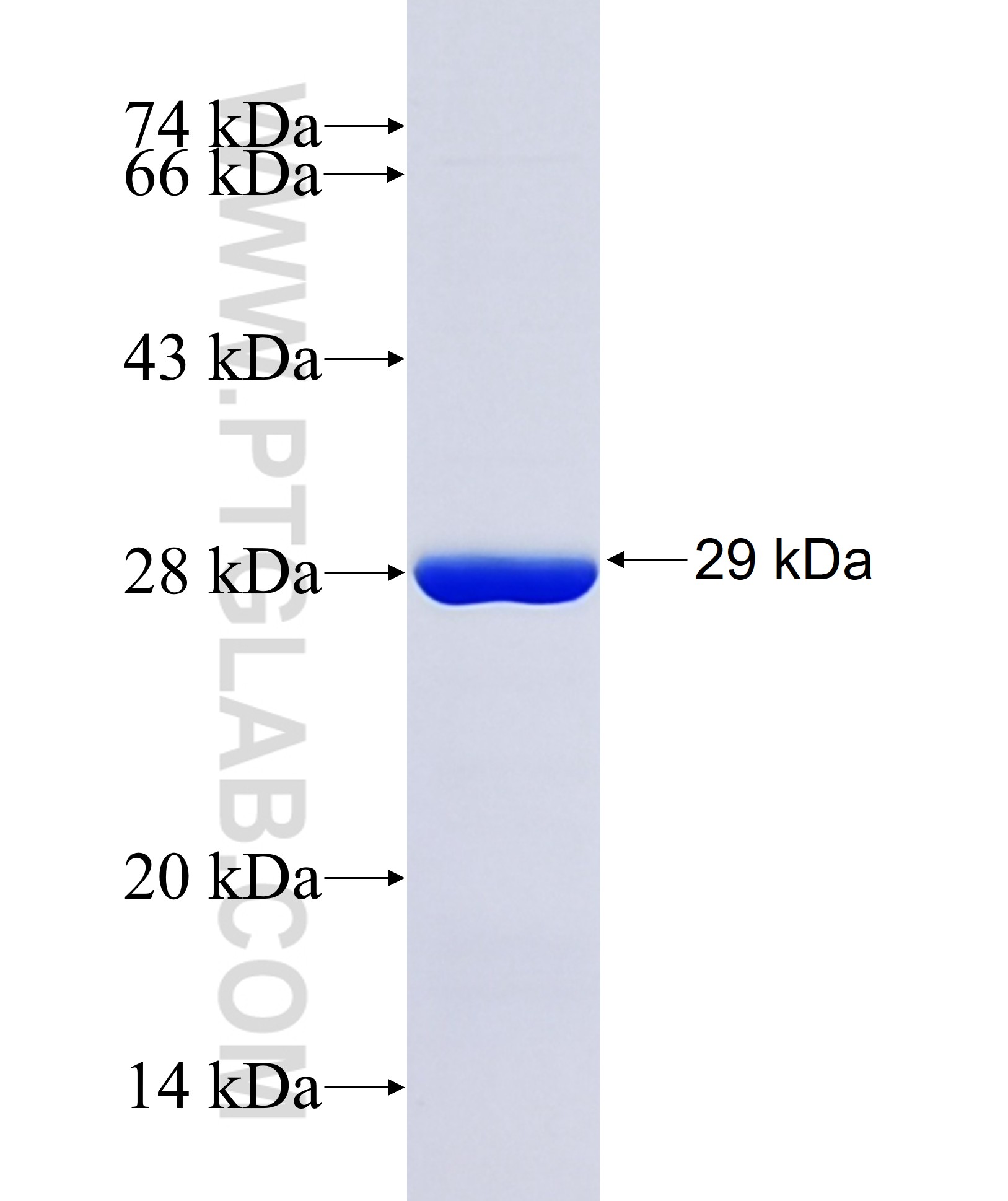 RGS9BP fusion protein Ag37846 SDS-PAGE RGS9BP fusion protein Ag37846 SDS-PAGE