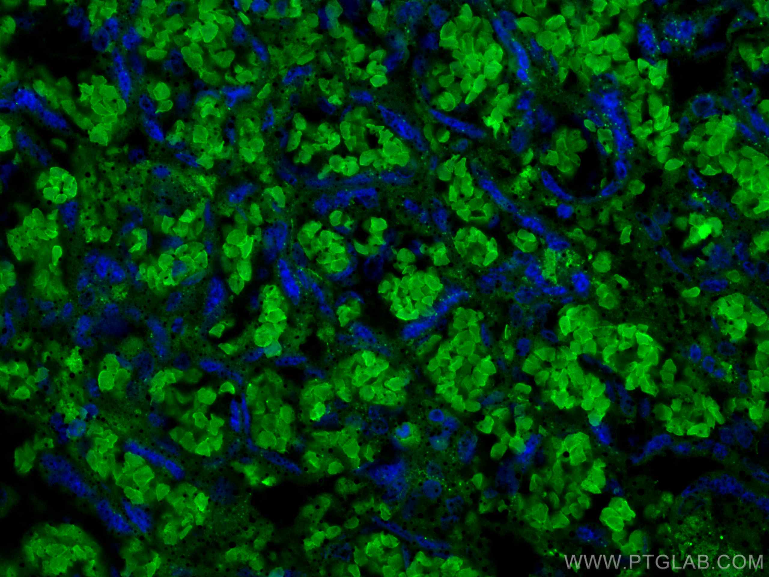 IF Staining of human placenta using 67714-1-Ig (same clone as 67714-1-PBS)