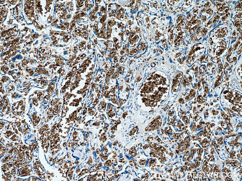 IHC staining of human placenta using 67714-1-Ig (same clone as 67714-1-PBS)