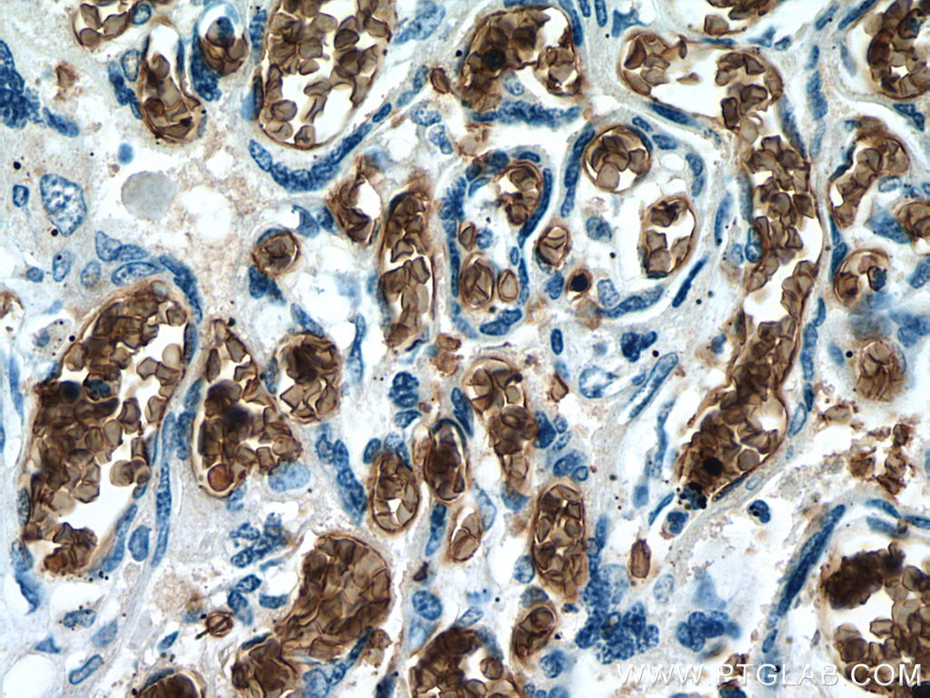 IHC staining of human placenta using 67714-1-Ig (same clone as 67714-1-PBS)