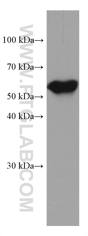 WB analysis of human placenta using 67714-1-Ig (same clone as 67714-1-PBS)