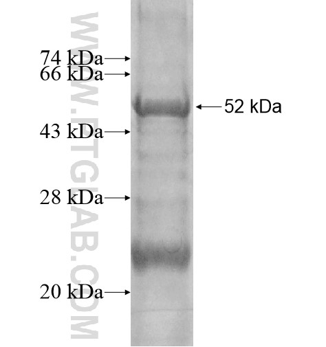 RHBDD3 fusion protein Ag14303 SDS-PAGE RHBDD3 fusion protein Ag14303 SDS-PAGE