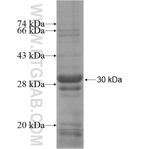 RHBDD3 fusion protein Ag14737 SDS-PAGE RHBDD3 fusion protein Ag14737 SDS-PAGE