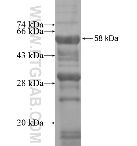 RHBDF1 fusion protein Ag13147 SDS-PAGE RHBDF1 fusion protein Ag13147 SDS-PAGE