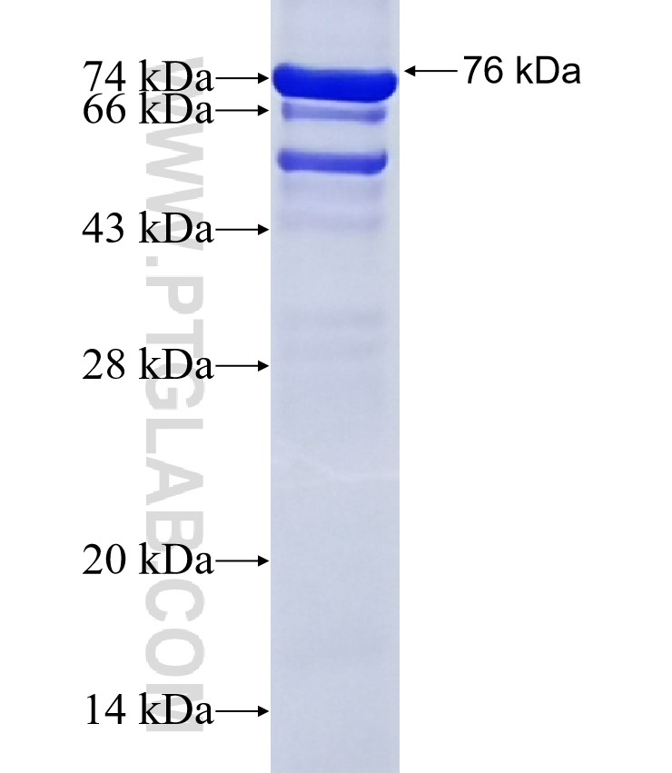 RHBDF1 fusion protein Ag13175 SDS-PAGE RHBDF1 fusion protein Ag13175 SDS-PAGE