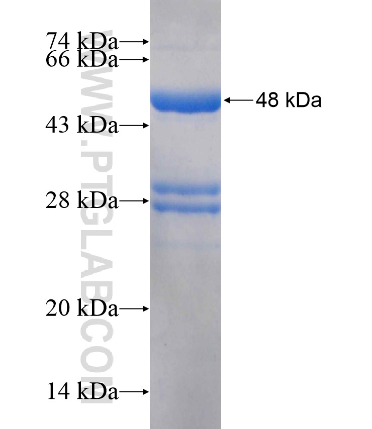 RHBDL1 fusion protein Ag18104 SDS-PAGE RHBDL1 fusion protein Ag18104 SDS-PAGE