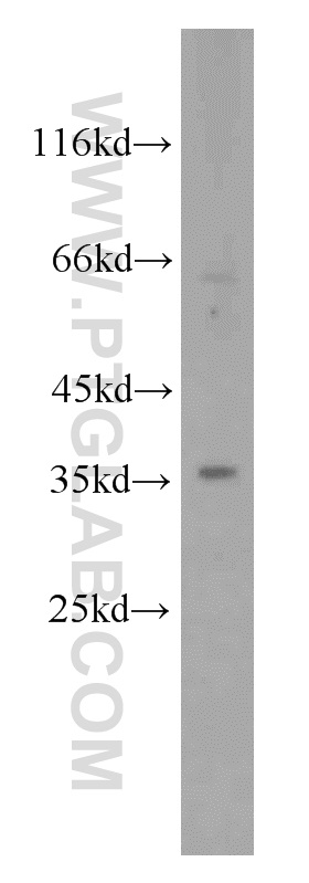 WB analysis of HeLa using 12467-1-AP