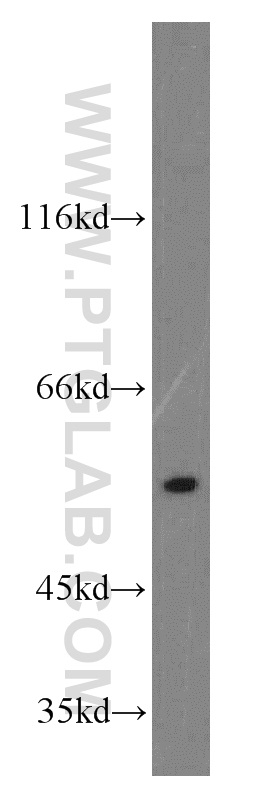 WB analysis of HEK-293 using 11949-1-AP