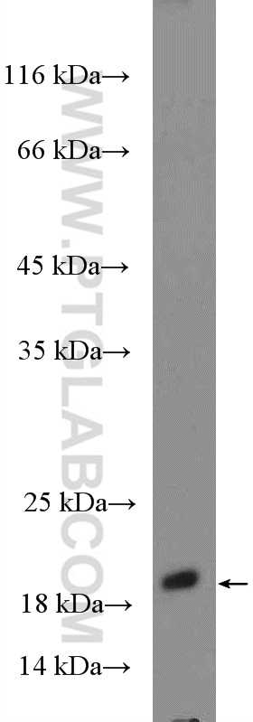 WB analysis of fetal human brain using 15924-1-AP