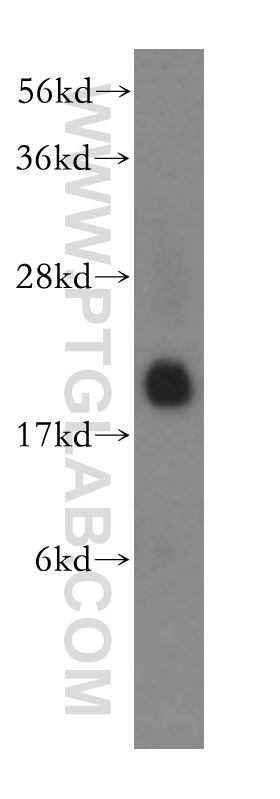 RHEB Polyclonal antibody