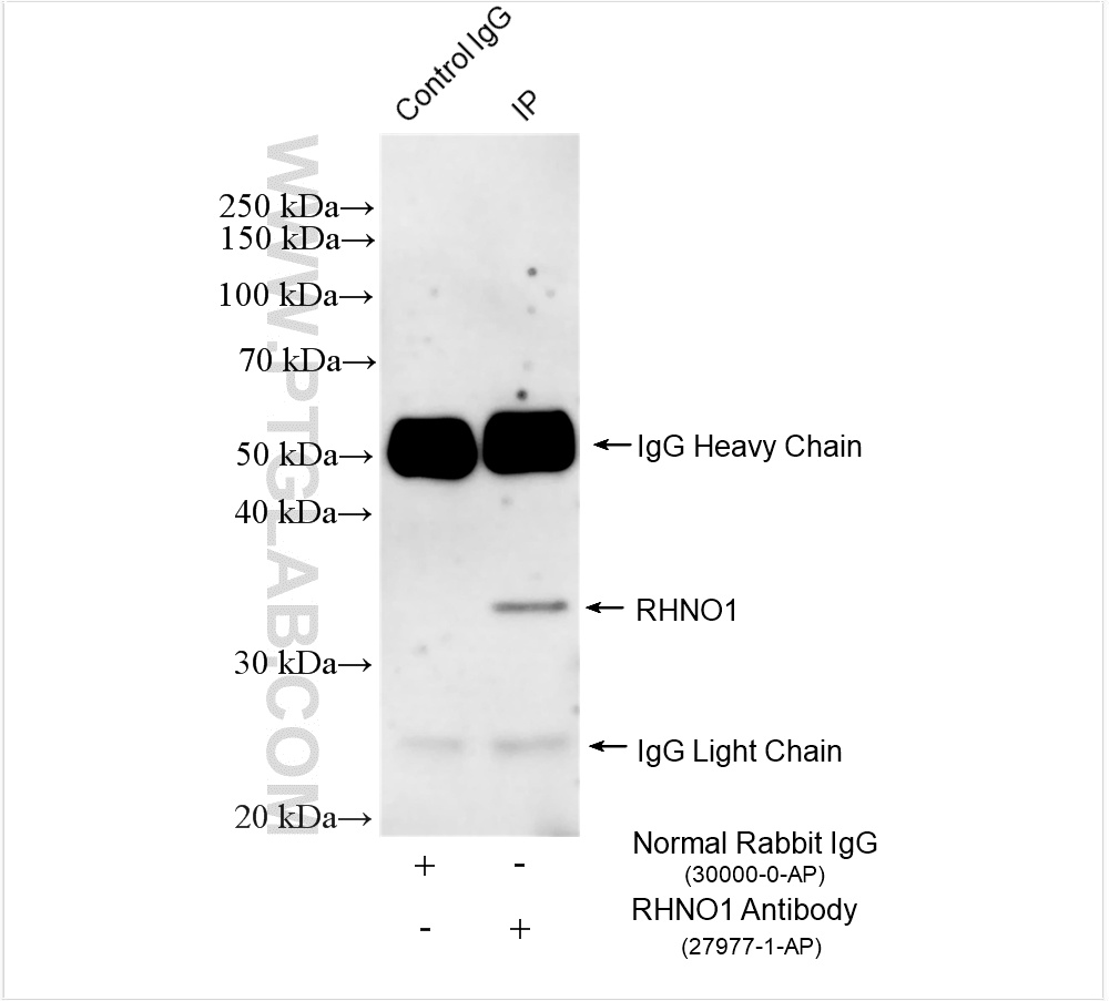 IP experiment of mouse thymus using 27977-1-AP IP experiment of mouse thymus using 27977-1-AP