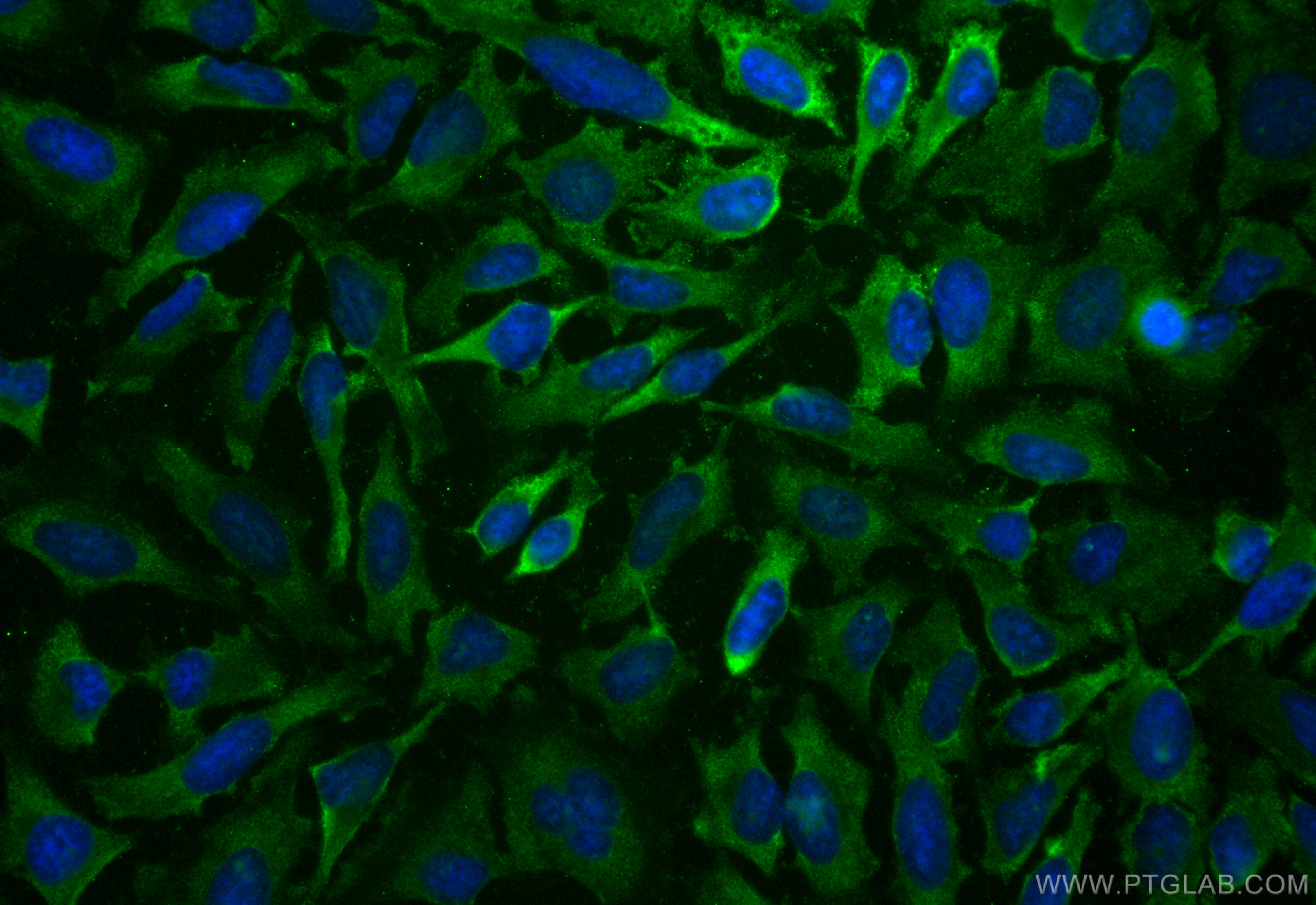 IF Staining of HeLa using CL488-82760-2