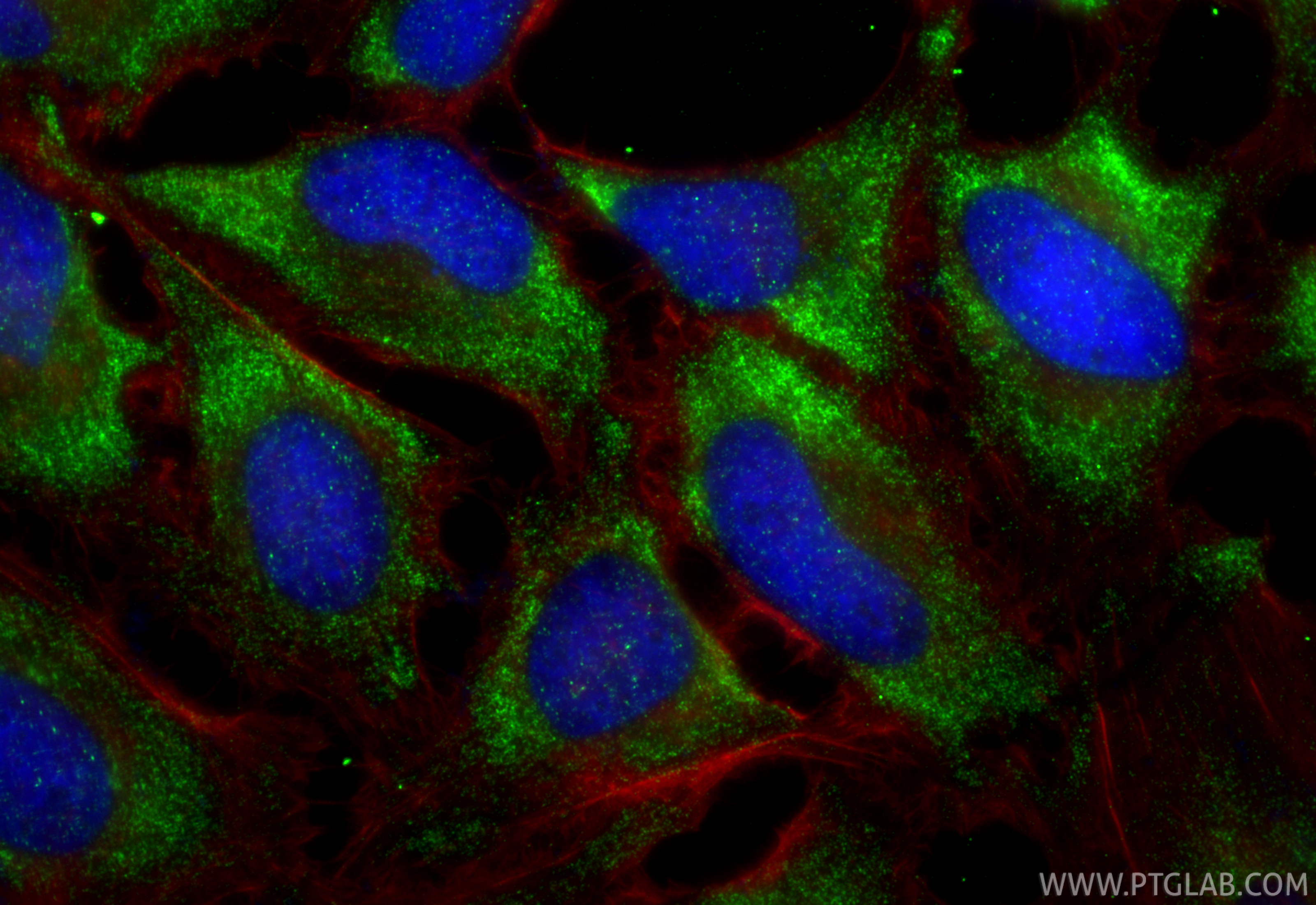 IF Staining of HeLa using RMX00030 IF Staining of HeLa using RMX00030