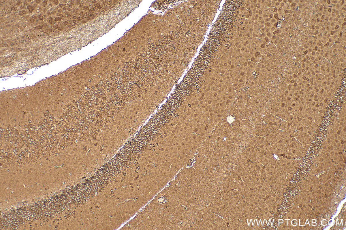 IHC staining of mouse brain using RMX00030 IHC staining of mouse brain using RMX00030