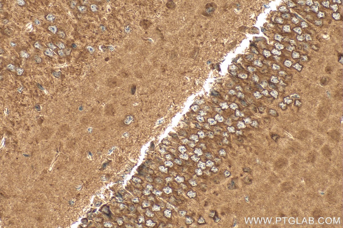 IHC staining of mouse brain using RMX00030 IHC staining of mouse brain using RMX00030