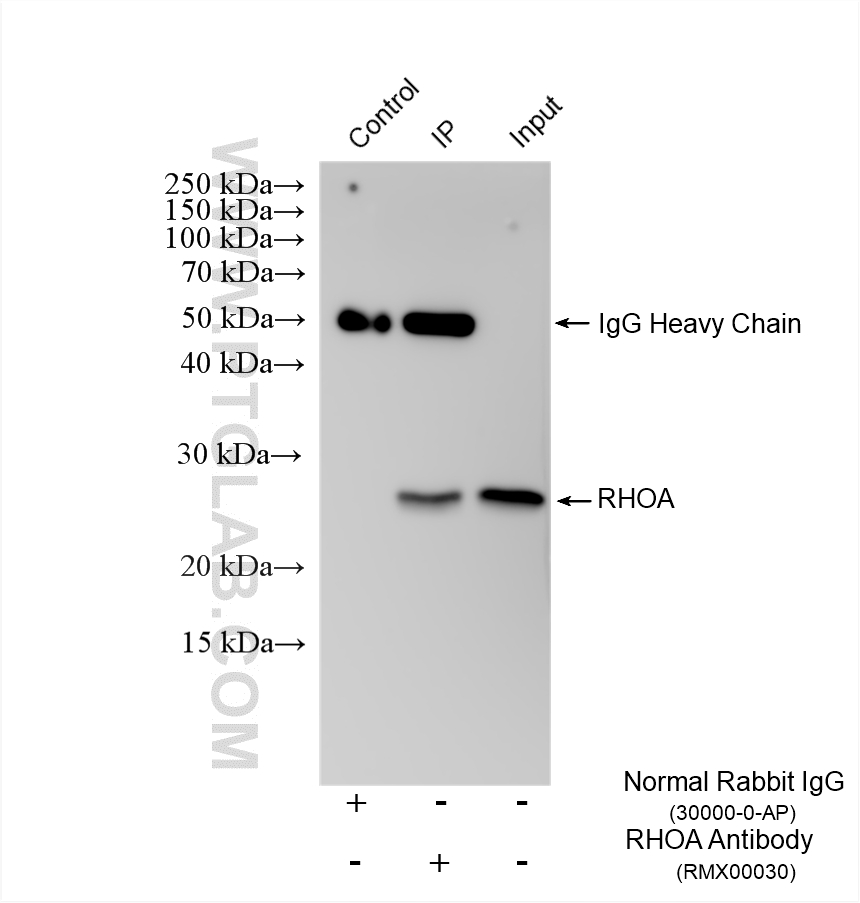 IP experiment of mouse brain using RMX00030 IP experiment of mouse brain using RMX00030