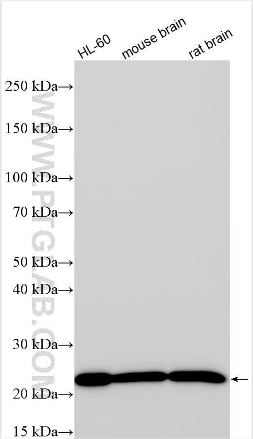 WB analysis using RMX00030 WB analysis using RMX00030