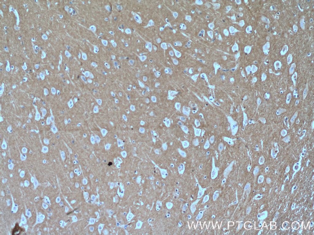 IHC staining of human brain using 14326-1-AP