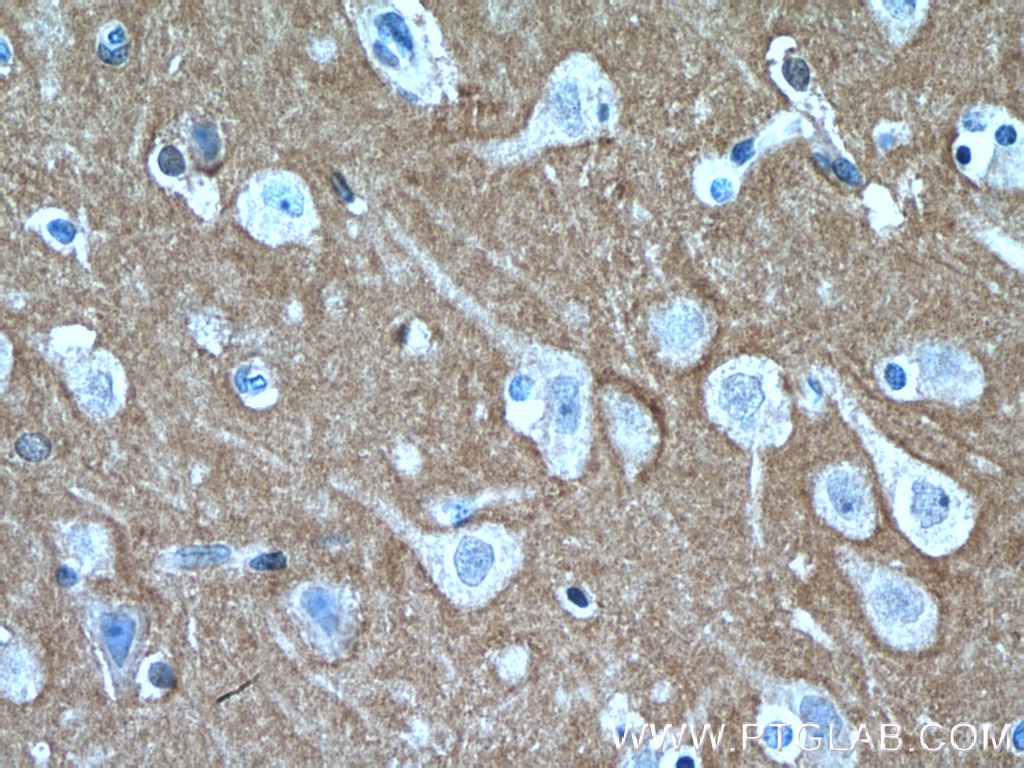 IHC staining of human brain using 14326-1-AP