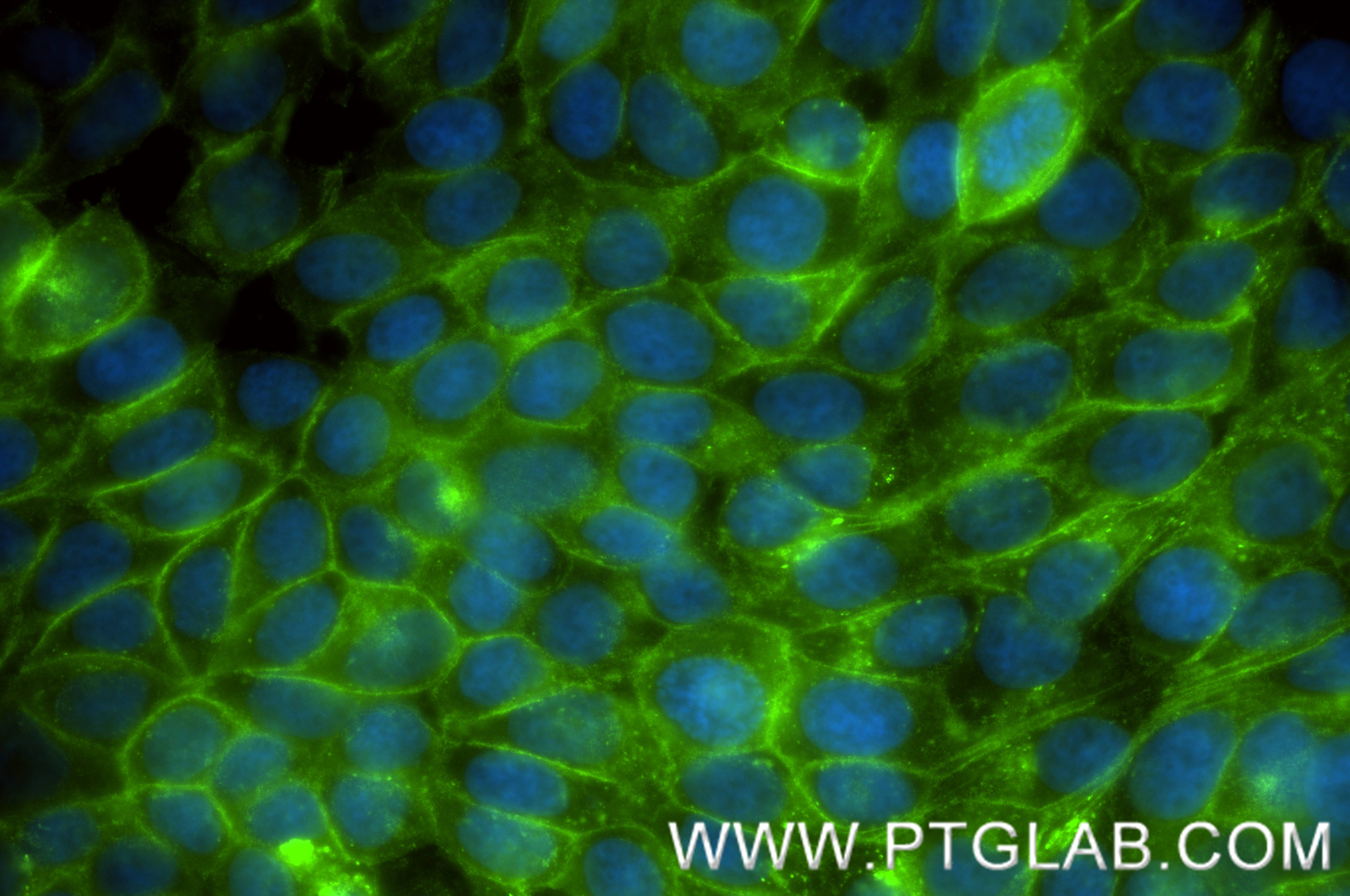 IF Staining of MCF-7 using 86663-4-RR IF Staining of MCF-7 using 86663-4-RR