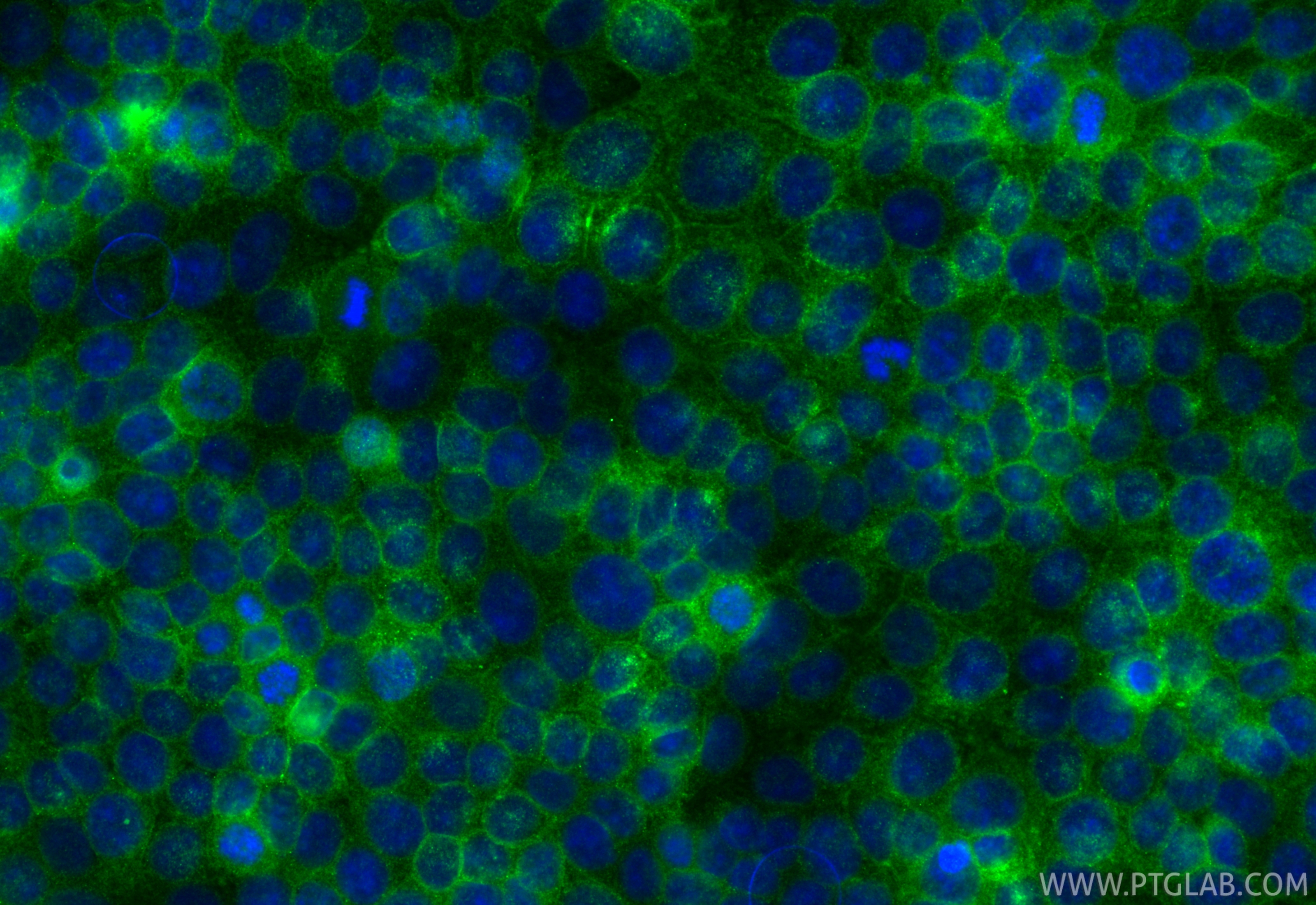 IF Staining of MCF-7 using RMX00061 IF Staining of MCF-7 using RMX00061