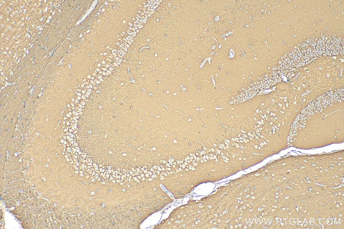 IHC staining of mouse brain using RMX00061 IHC staining of mouse brain using RMX00061