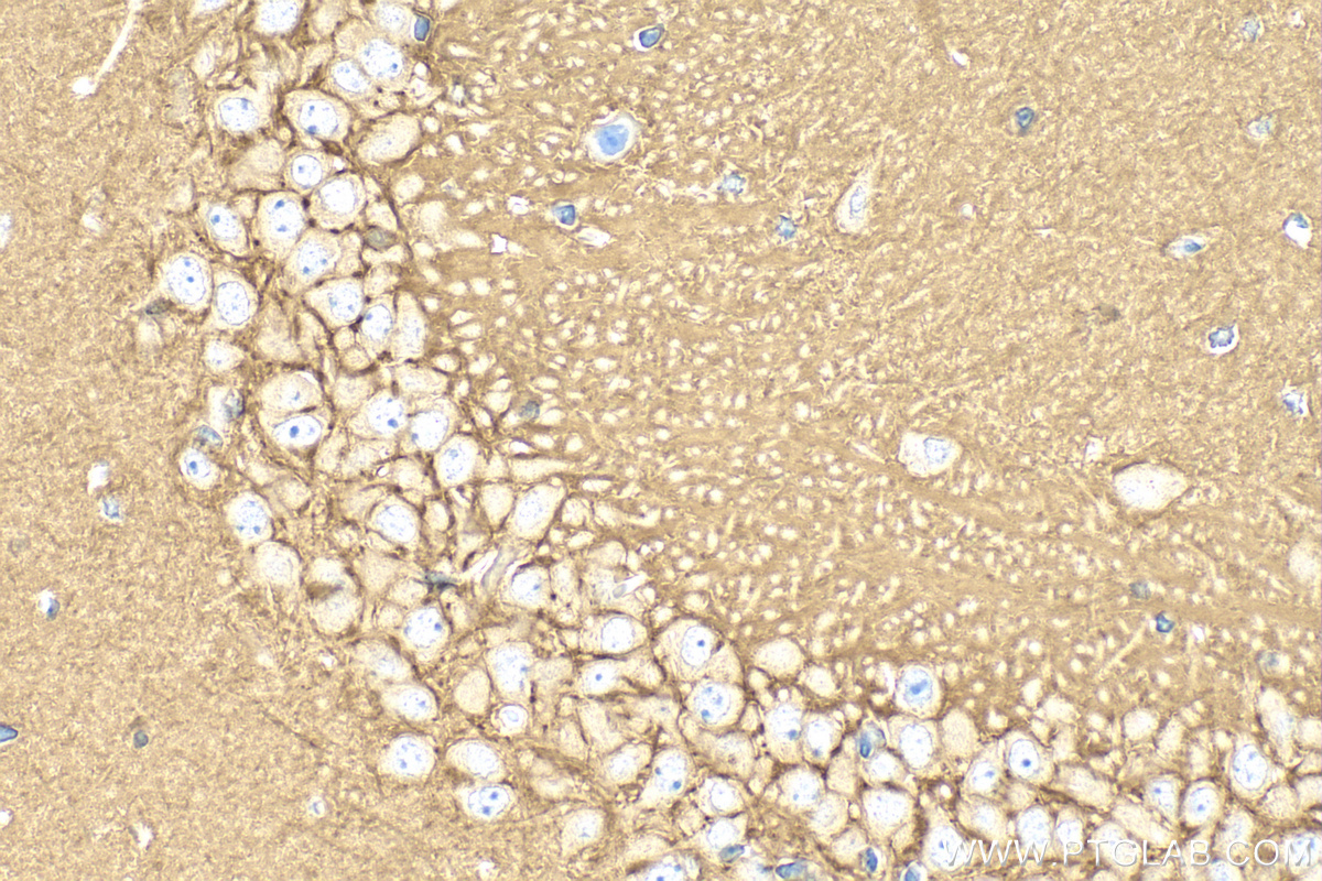 IHC staining of mouse brain using RMX00061 IHC staining of mouse brain using RMX00061
